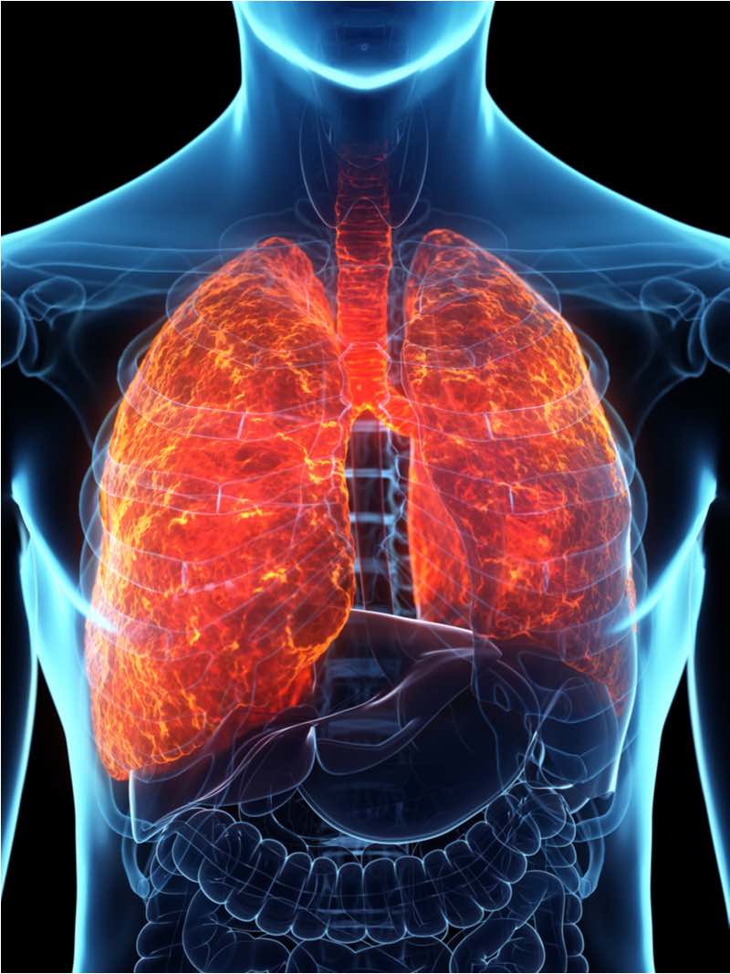 acute respiratory distress syndrome pantherna therpeutics inflammatory lung disease
