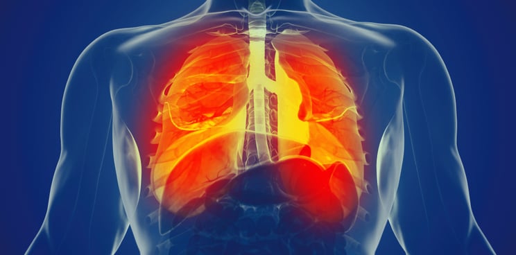 chronic lung disease verona pharma