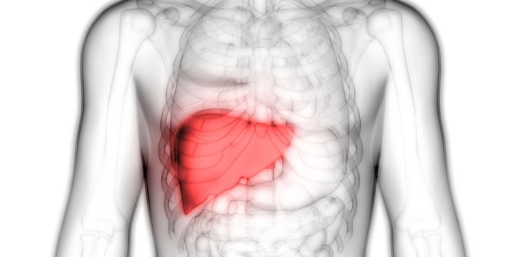 liver cirrhosis treatment versantis