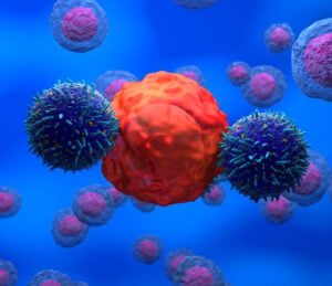 natural killer/T-cell lymphoma NKTL