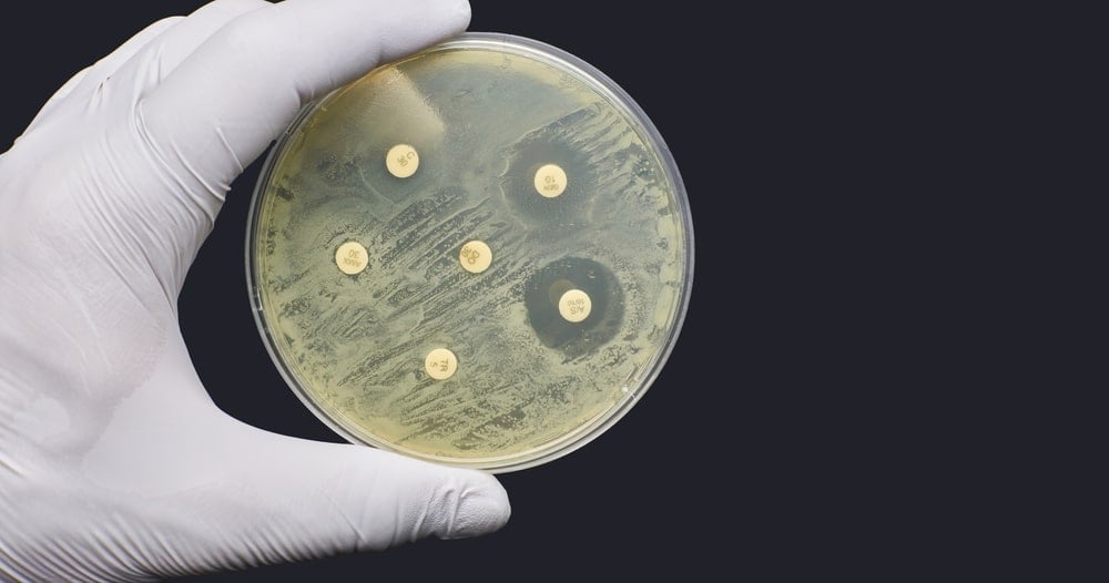 microbial resistance