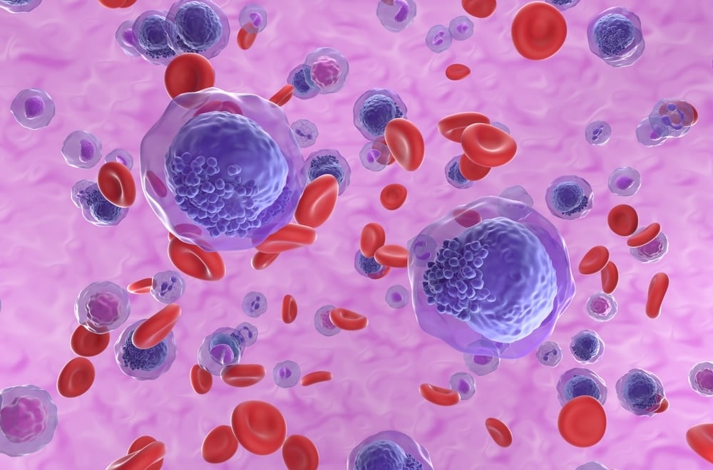 AML leukaemia leukemia
