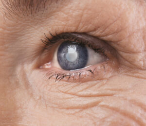 eye disease geographic atrophy