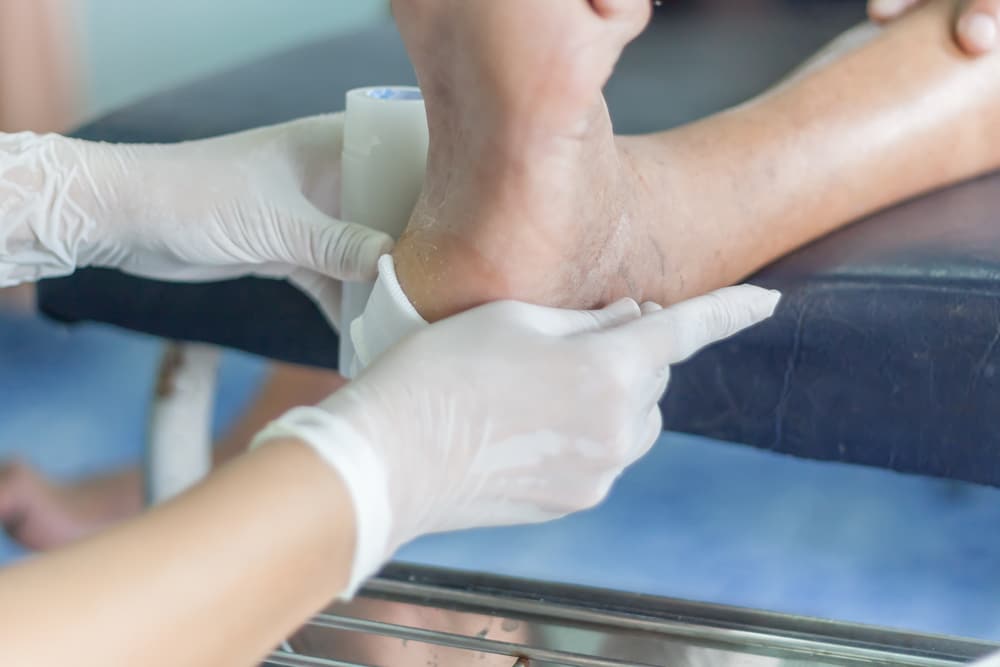 Ilya Pharma enrols first patient in diabetic foot ulcer study